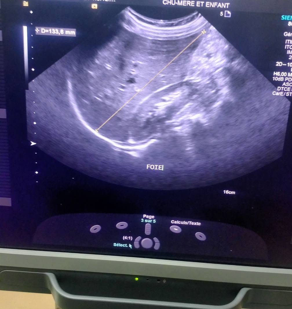 Gynecology
